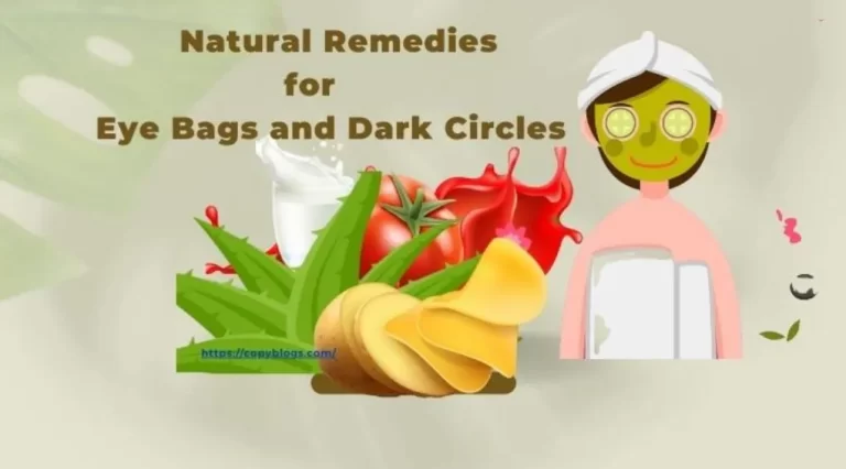 Natural Remedies for Eye Bags and Dark Circles