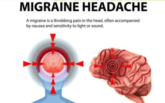 NATURAL REMEDIES FOR HEADACHES AND MIGRAINES