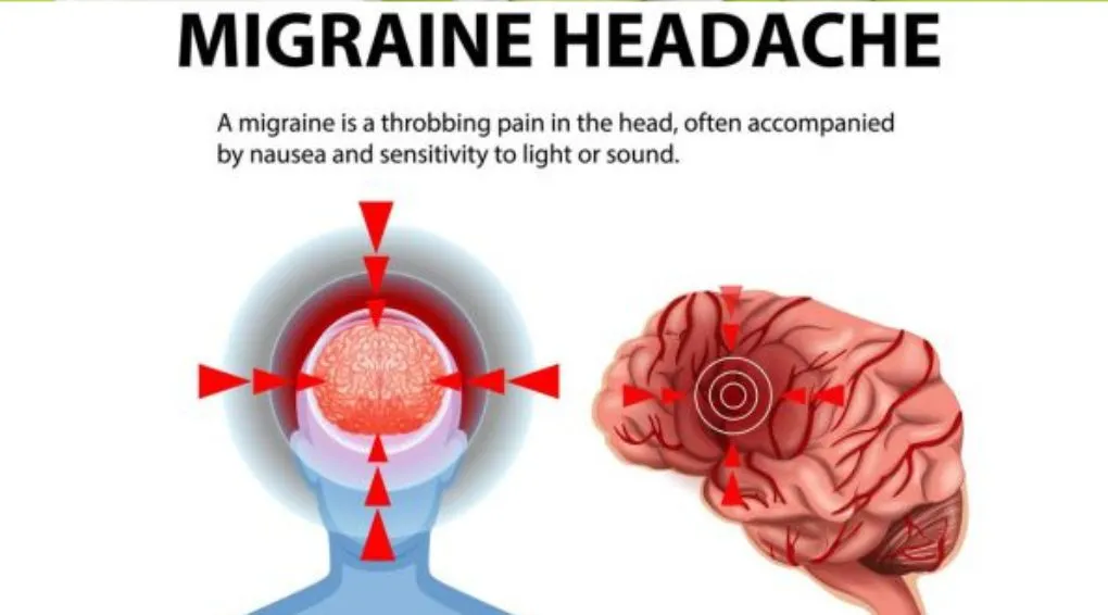 NATURAL REMEDIES FOR HEADACHES AND MIGRAINES