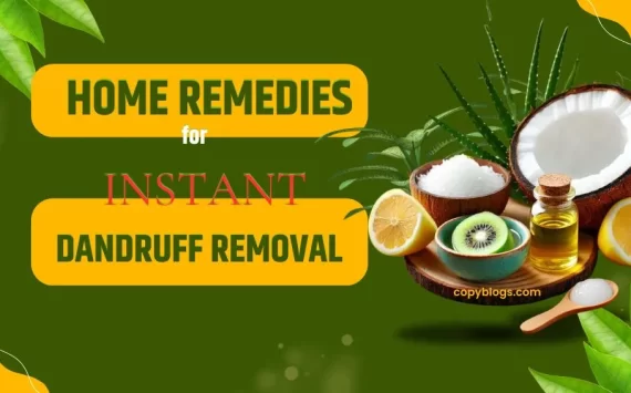 HOME REMEDIES FOR INSTANT DANDRUFF REMOVAL