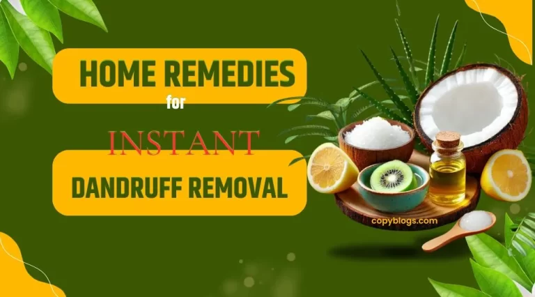 Home Remedies for Instant Dandruff Removal