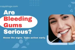 Bleeding Gums: Causes, Treatments, and Prevention