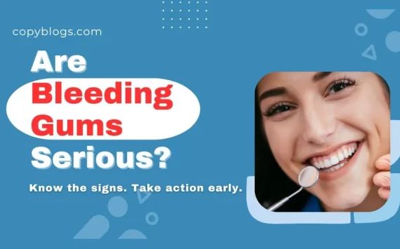 Bleeding Gums: Causes, Treatments, and Prevention