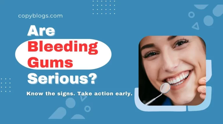 Are Bleeding Gums Serious