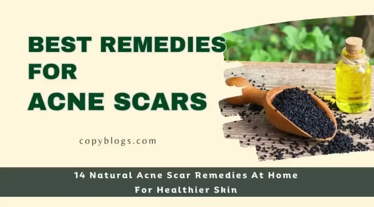 Best natural acne scar remedies at home with black seed oil, aloe vera on a table.