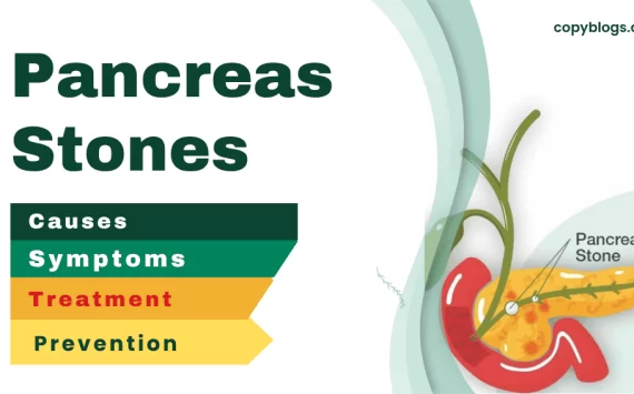 Pancreatic Stones: Causes, Symptoms, and Effective Treatment Options